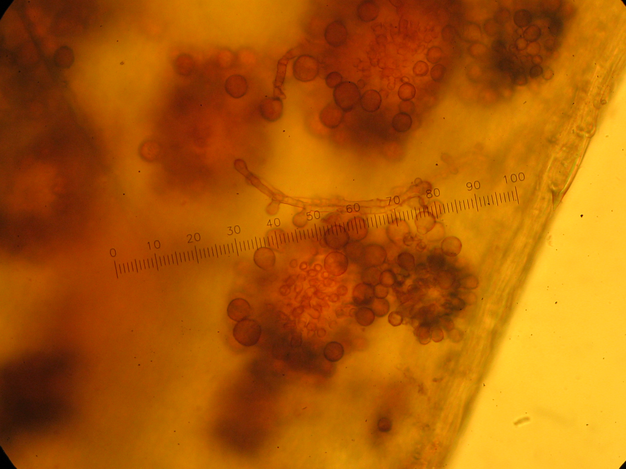 What is rust disease? - Article